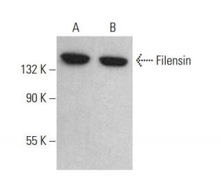 Filensin Antibody (IB38) - Western Blotting - Image 380731