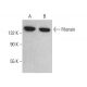 Filensin Antibody (IB38) - Western Blotting - Image 380731