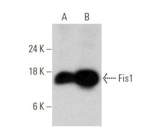 western blotting image from recommended Fis1 (B-5) monoclonal antibody replacement. Image 356190