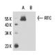 FITC Antibody (FITC-11) - Western Blotting - Image 17599 