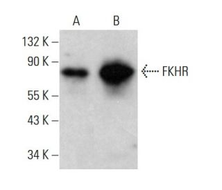 FKHR/FOXO1 Antibody (A-6) - Western Blotting - Image 376613 