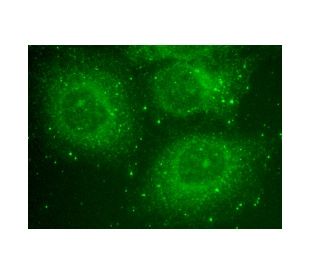 アップビー 正規品】KOSOヒップアップアダプタ42mmUP青 スーパーディオSR