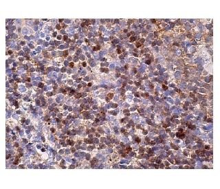 FKHR/FOXO1 Antibody (C-9) | SCBT - Santa Cruz Biotechnology