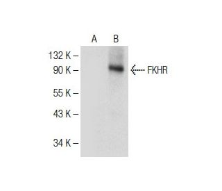 FKHR/FOXO1 Antibody (C-9) | SCBT - Santa Cruz Biotechnology
