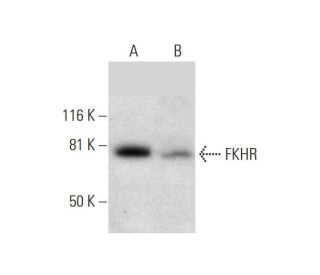 FKHR/FOXO1 Antibody (C-9) - Western Blotting - Image 295924
