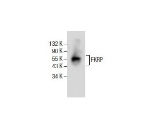 FKRP Antibody (E-4) - Western Blotting - Image 154910