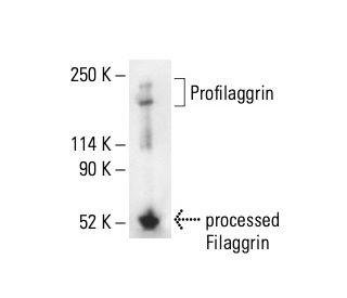 FLG/Filaggrin Antibody (AE21) - Western Blotting - Image 411961