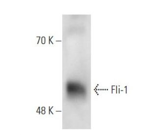 Fli-1 Antibody (7.3) - Western Blotting - Image 17161