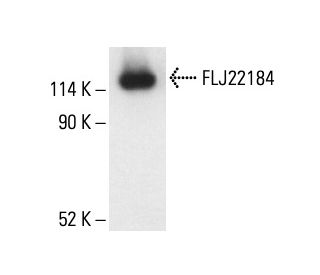 FLJ22184 Antibody (D-3) - Western Blotting - Image 411789