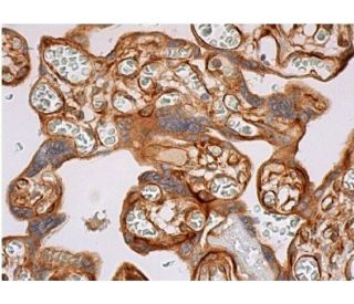 immunohistochemistry image from recommended Flk-1/KDR/VEGFR2 (D-8) monoclonal antibody replacement. Image 353882