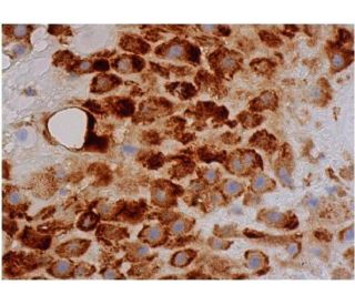 immunohistochemistry image from recommended Flt-1/VEGFR1 (D-2) monoclonal antibody replacement. Image 354229
