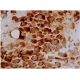 immunohistochemistry image from recommended Flt-1/VEGFR1 (D-2) monoclonal antibody replacement. Image 354229