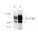 western blotting image from recommended Flt-3/Flk-2 (SF1.340) monoclonal antibody replacement. Image 374114