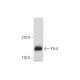 This polyclonal antibody has been discontinued. See our recommended <a href="flt-4-antibody-e-3">Flt-4 (E-3)</a> monoclonal antibody (sample data shown). western blotting image from recommended Flt-4 (E-3) monoclonal antibody replacement. Image 333365