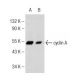 Flurbiprofen: sc-202158. Western blot analysis of cyclin A expression in untreated (A) and Flurbiprofen treated (B) Caco-2 