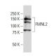 FMNL2 Antibody (32-T) - Western Blotting - Image 34314