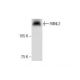 FMNL2 Antibody (G-8) - Western Blotting - Image 286891