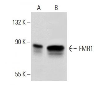 western blotting image from recommended FMR1 (148.1) monoclonal antibody replacement. Image 41054