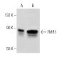 This polyclonal antibody has been discontinued. See our recommended <a href="fmr1-antibody-148-1">FMR1 (148.1)</a> monoclonal antibody (sample data shown). western blotting image from recommended FMR1 (148.1) monoclonal antibody replacement. Image 41054