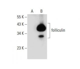 folliculin Antibody (D-4) - Western Blotting - Image 133866 