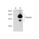 folliculin Antibody (D-4) - Western Blotting - Image 133866 
