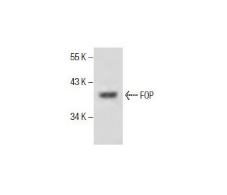 FOP Antibody (B-1) - Western Blotting - Image 286128Each CRISPR/Cas9 Knockout (KO) Plasmid product consists of a pool of 3 plasmids designed to ensure identification and cleavage of a specific gene for maximum knockout efficiency. Each plasmid encodes a unique 20 nt sequence derived from the GeCKO (v2) library. 