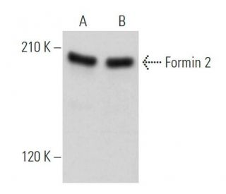 Formin 2 Antibody (C-3) - Western Blotting - Image 373362 