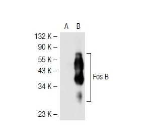 Fos B Antibody (83B1138) - Western Blotting - Image 40522 