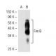 Fos B Antibody (83B1138) - Western Blotting - Image 40522 