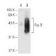 Fos B Antibody (83B1138) - Western Blotting - Image 62536