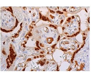 immunohistochemistry image from recommended Fos B (F-7) monoclonal antibody replacement. Image 348024