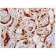 immunohistochemistry image from recommended Fos B (F-7) monoclonal antibody replacement. Image 348024