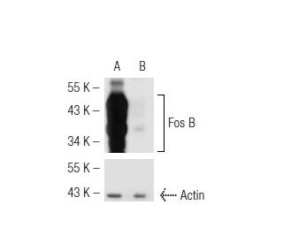 Fos B shRNA Plasmid (h): sc-35403-SH. Western blot analysis of human Fos B expression in Fos B transfected (A) and Fos B/F 