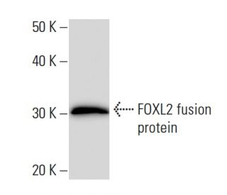 FOXL2 Antibody (262C1a) - Western Blotting - Image 16659Each CRISPR/Cas9 Knockout (KO) Plasmid product consists of a pool of 3 plasmids designed to ensure identification and cleavage of a specific gene for maximum knockout efficiency. Each plasmid encodes a unique 20 nt sequence derived from the GeCKO (v2) library. 