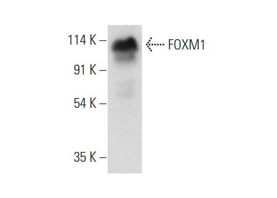 骨ｆ FOXM1 Antibody (A-11) | SCBT - Santa Cruz Biotechnology