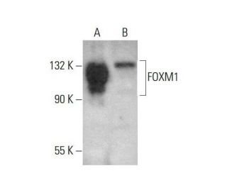 その他 T FOXM1 Antibody (A-11) | SCBT - Santa Cruz Biotechnology