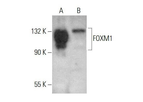 骨ｆ FOXM1 Antibody (A-11) | SCBT - Santa Cruz Biotechnology