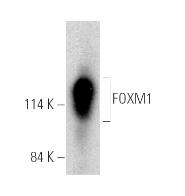 骨ｆ FOXM1 Antibody (A-11) | SCBT - Santa Cruz Biotechnology