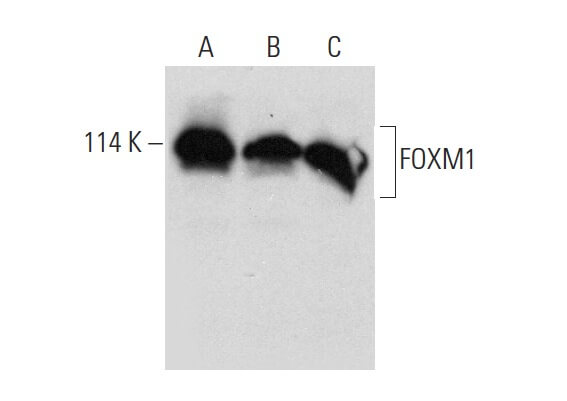 FOXM1 Antibody (G-5) | SCBT - Santa Cruz Biotechnology