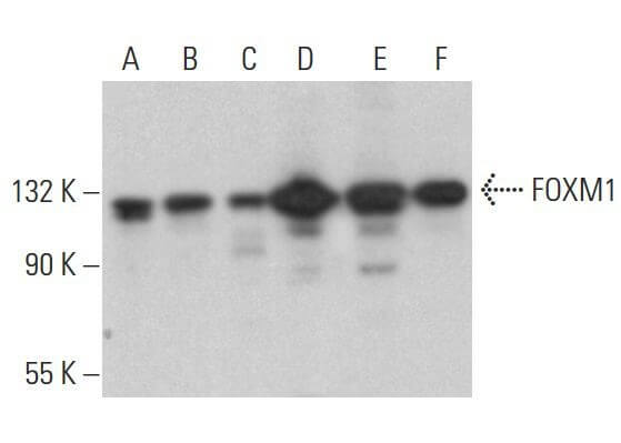 FOXM1 Antibody (G-5) | SCBT - Santa Cruz Biotechnology
