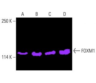 角結膜がみえてくる 生体共焦点顕微鏡検査?In vivo Biopsy 近間