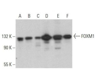 western blotting image from recommended FOXM1 (G-5) monoclonal antibody replacement. Image 353178