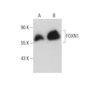 western blotting image from recommended FOXN1 (E-3) monoclonal antibody replacement. Image 131192