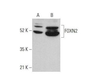 FOXN2 Antibody (D-4) - Western Blotting - Image 375588 
