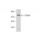 FOXN4 Antibody (G-1) - Western Blotting - Image 304952