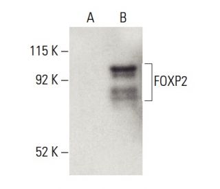 western blotting image from recommended FOXP2 (5C11A8) monoclonal antibody replacement. Image 399492