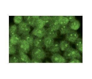 immunofluorescence image from recommended FOXP3 (2A11G9) monoclonal antibody replacement. Image 15949