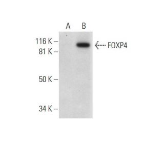FOXP4 Antibody (D-8) - Western Blotting - Image 291011 
