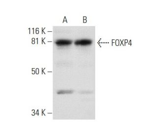FOXP4 Antibody (D-8) - Western Blotting - Image 301284 