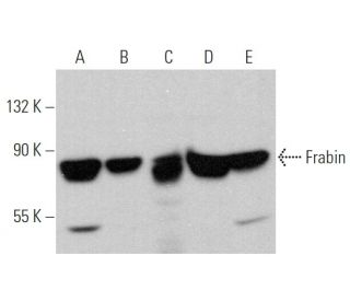 Frabin Antibody (43) - Western Blotting - Image 378680 